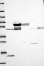 Anti-GALNT16 Antibody