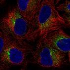 Anti-SLC39A9 Antibody