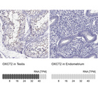 Anti-OXCT2 Antibody