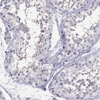 Anti-OXCT2 Antibody