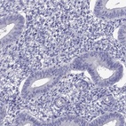 Anti-OXCT2 Antibody