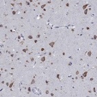 Anti-TMEM59 Antibody