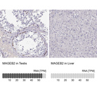 Anti-MAGEB2 Antibody