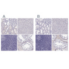 Anti-MAGEB2 Antibody