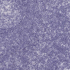 Anti-MAGEB2 Antibody