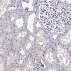 Anti-MAGEB2 Antibody