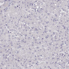 Anti-MAGEB2 Antibody