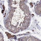 Anti-IPP Antibody