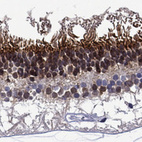 Anti-MSI1 Antibody