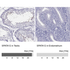 Anti-SPATA12 Antibody