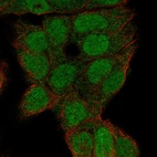 Anti-LMX1B Antibody