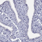 Anti-NPL Antibody