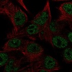 Anti-CEMP1 Antibody