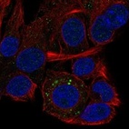 Anti-QPRT Antibody