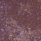 Anti-RHOF Antibody