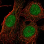 Anti-TXNL4A Antibody