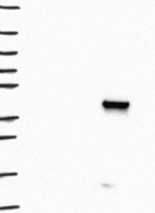 Anti-UPB1 Antibody