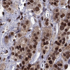 Anti-FBXO16 Antibody