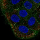 Anti-TBC1D2 Antibody