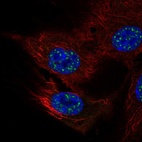 Anti-NFATC4 Antibody