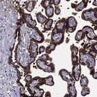 Anti-SERPINB2 Antibody