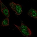 Immunofluorescent staining of human cell line U-251 MG shows localization to nucleoplasm.