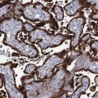 Anti-SERPINB2 Antibody