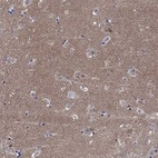 Anti-CPNE6 Antibody