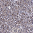 Anti-TPRN Antibody