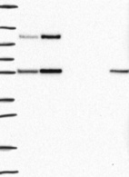 Anti-TPRN Antibody