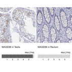 Anti-MAGEB6 Antibody