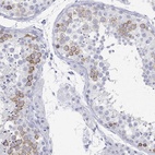 Anti-MAGEB6 Antibody