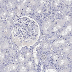 Anti-EPX Antibody