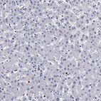 Anti-EPX Antibody