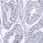 Anti-EPX Antibody