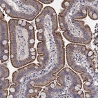 Anti-ERN2 Antibody