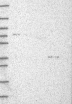 Anti-DHRS1 Antibody