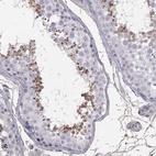 Anti-SUN3 Antibody