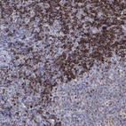 Anti-HLA-DOA Antibody