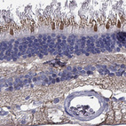 Anti-CFAP161 Antibody