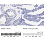 Anti-SMCP Antibody