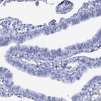 Anti-SMCP Antibody