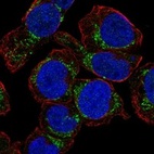 Anti-NHLRC4 Antibody