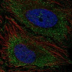 Anti-TNFAIP8L3 Antibody