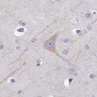 Anti-PCDH11X Antibody