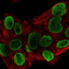 Anti-HNRNPA1L2 Antibody