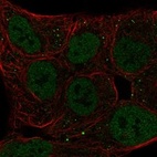 Anti-BHLHE41 Antibody