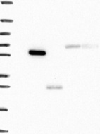 Anti-TMPRSS11D Antibody