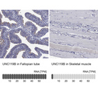 Anti-UNC119B Antibody