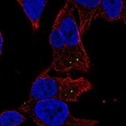 Anti-MAN2A2 Antibody